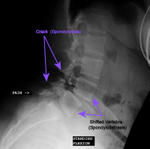2009-12-12-xray.jpg
